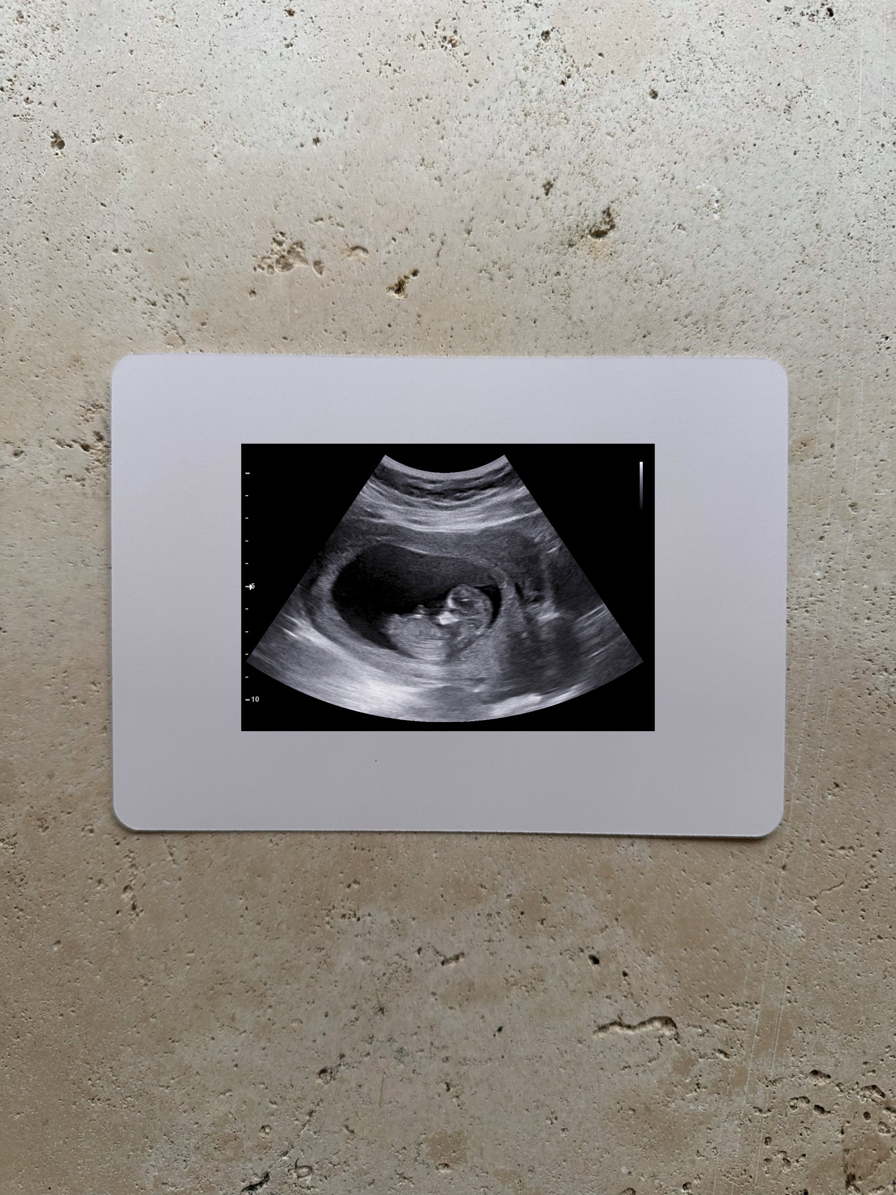 Baby On The Way Ultrasound Card